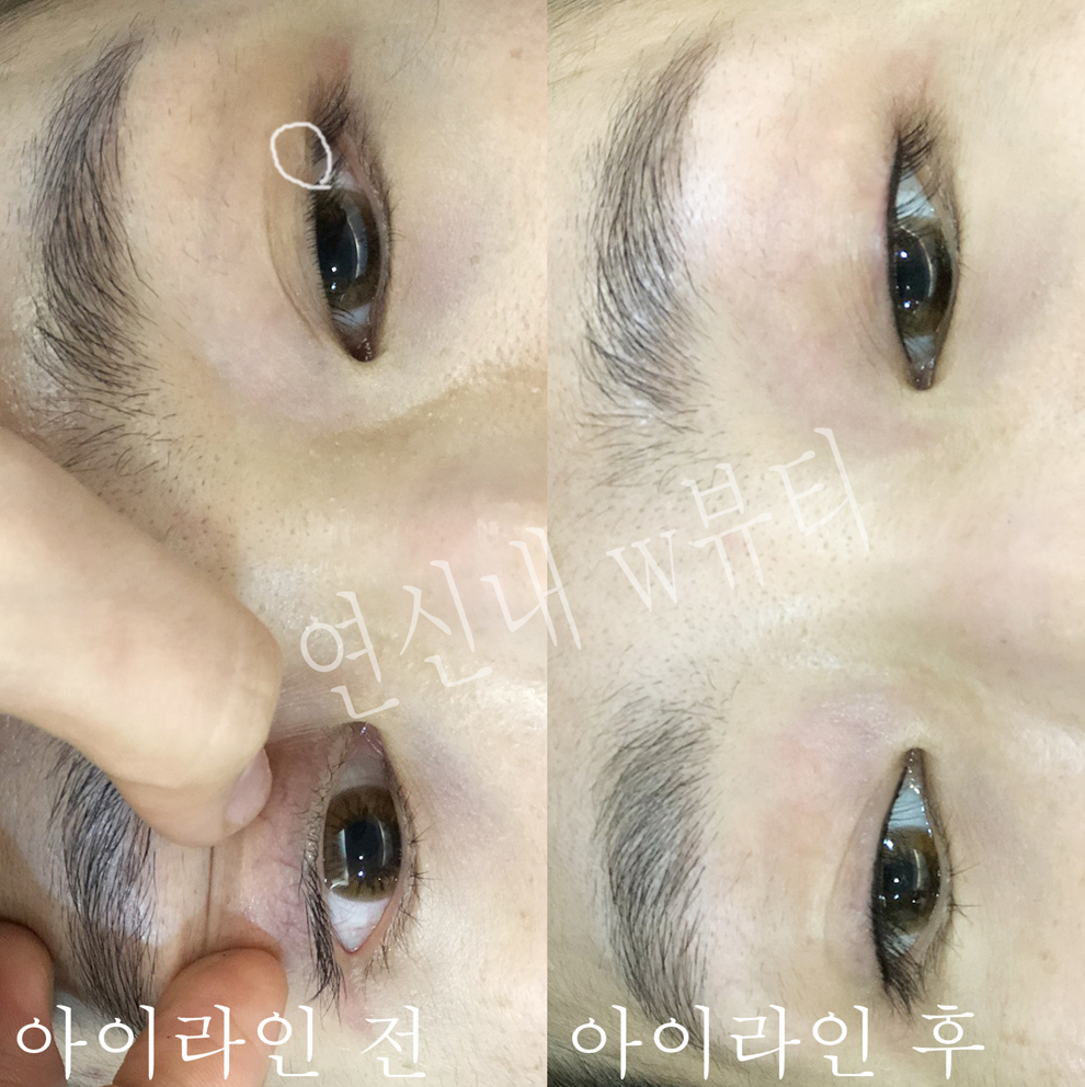 2949859459_jCdX7zr2_69539294bf460a7c1b1fceb0bbeb0735a8f6bb03.jpg 이미지크게보기